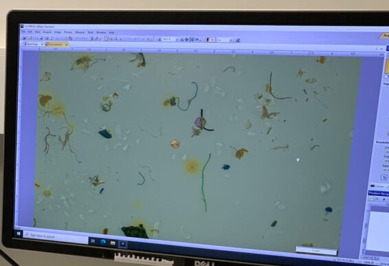 Microplastics under a microscope